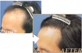 木村亮さんのBefore&After写真