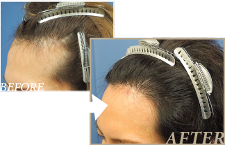 高橋こじろーさんのBefore&After写真