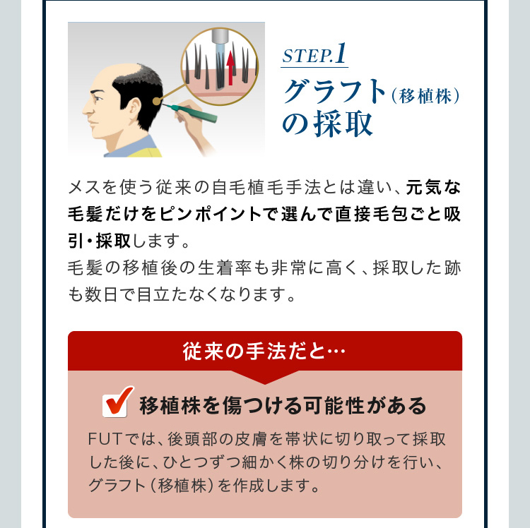 STEP1 グラフトの採取