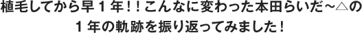 植毛してから早1年！！こんなに変わった本田らいだ~△の1年の軌跡を振り返ってみました！