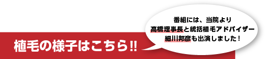 本田らいだー△植毛の様子はコチラ