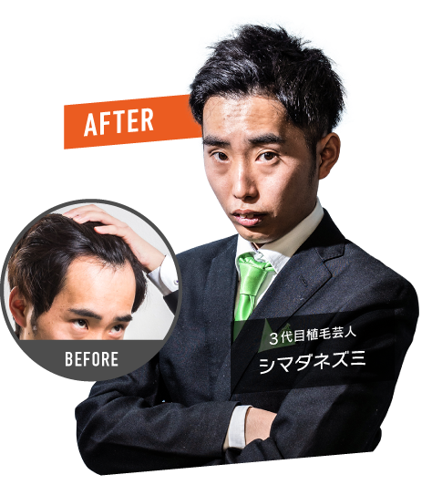 3代目植毛芸人 シマダネズミ BEFORE AFTER