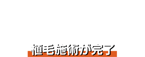 TREATMENT 植毛施術が完了