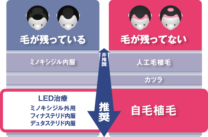 薄毛の状態による分類の図