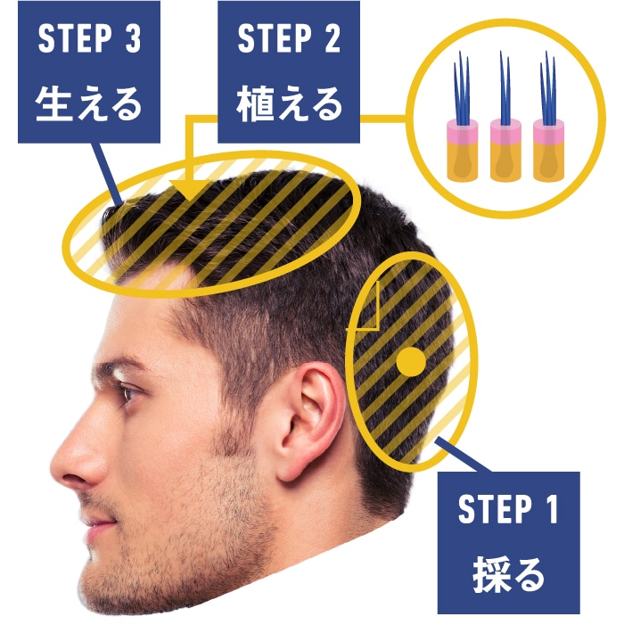 アイ・ダイレクトのステップ（採る、植える、生える）の図