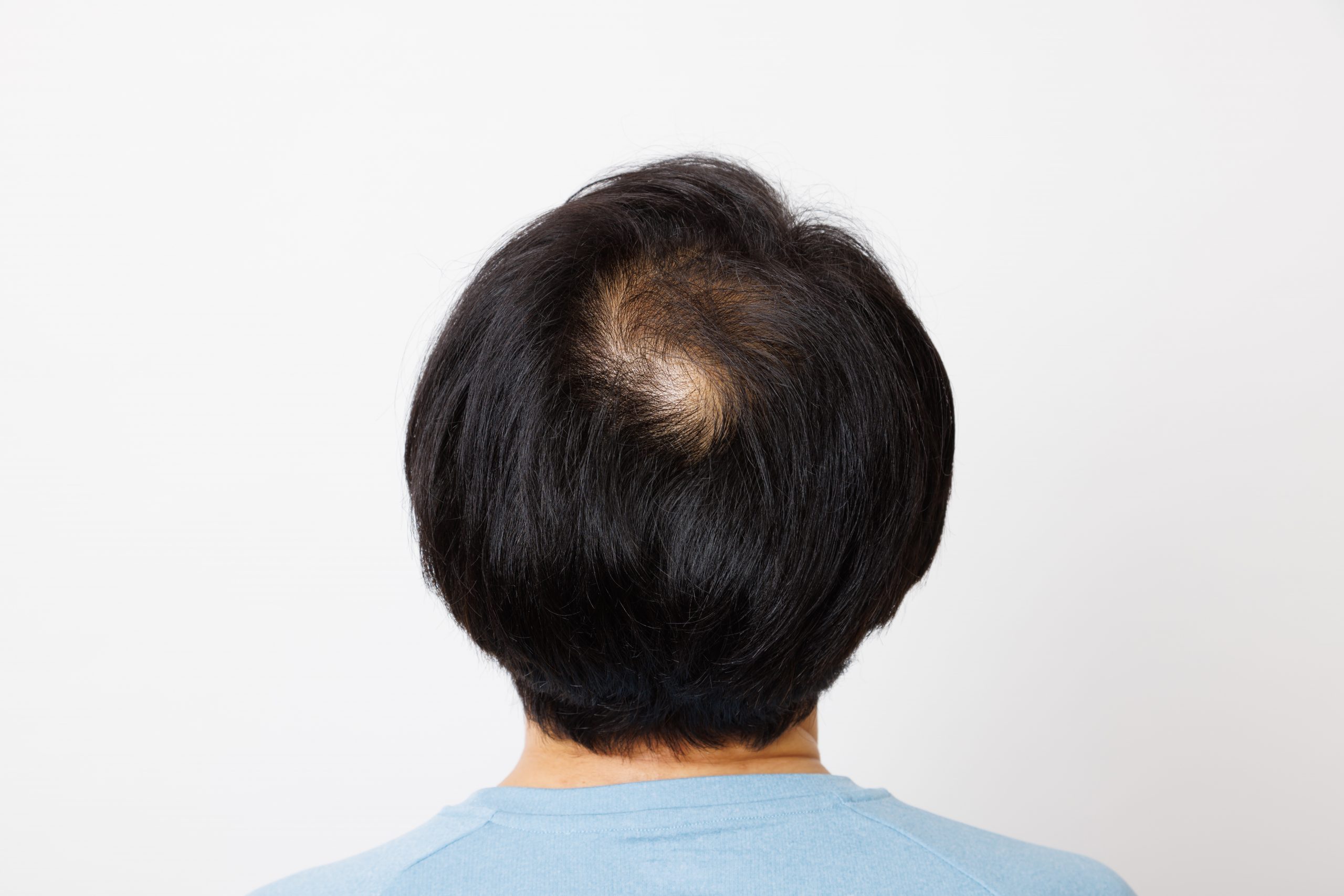 脱毛のある成熟した日本人男性の背景