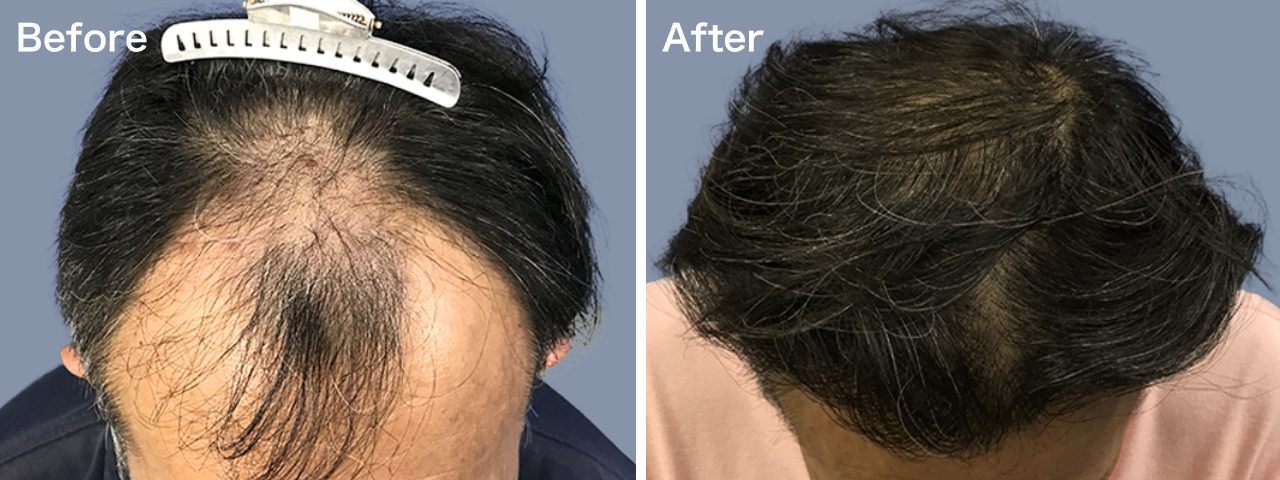 【新宿院/1800株】-2