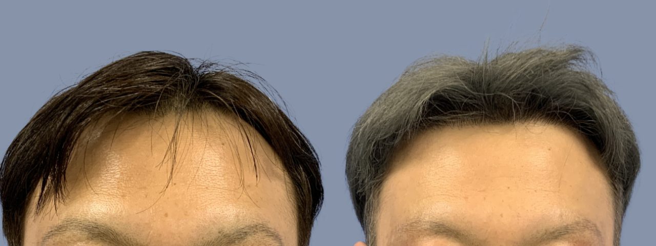 【福岡院/1400G】-2